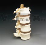 Budget Lumbar Vertebrae Sets